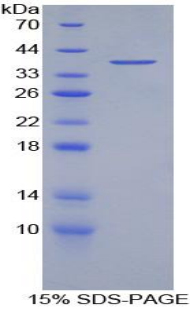 RPA539Hu02.jpg