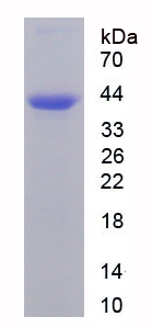 Recombinant Immunoglobulin A (IgA)