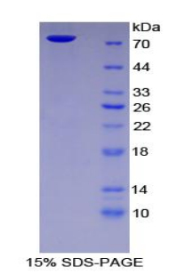 Recombinant Intercellular Adhesion Molecule 1 (ICAM1)