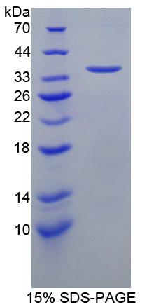 Recombinant Intercellular Adhesion Molecule 1 (ICAM1)