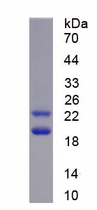 Recombinant Fibroblast Growth Factor 2, Basic (FGF2)