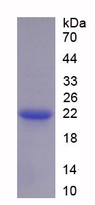 Recombinant Tissue Inhibitors Of Metalloproteinase 1 (TIMP1)