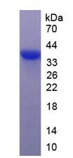 Recombinant Matrix Metalloproteinase 9 (MMP9)