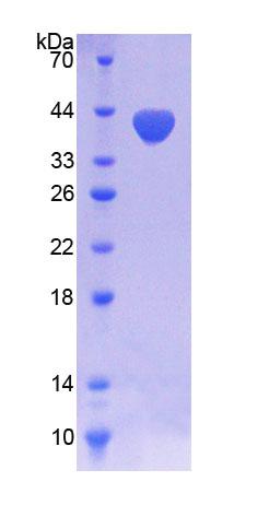 RPA555Hu01.jpg