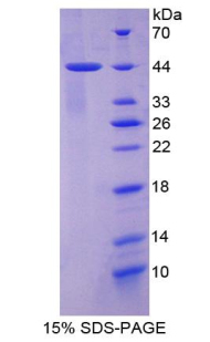 Recombinant Cytokeratin 7 (CK7)