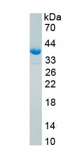 Recombinant Cytokeratin 7 (CK7)