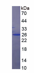 Recombinant Cytokeratin 7 (CK7)