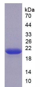 Recombinant Thyroid Peroxidase (TPO)