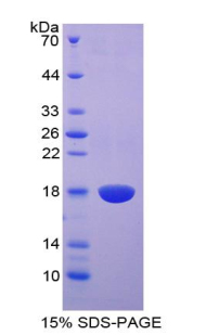 Recombinant Epidermal Growth Factor (EGF)