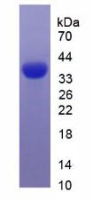 Recombinant Epidermal Growth Factor (EGF)