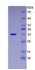 Recombinant Interleukin 1 Beta (IL1b)