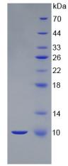 Recombinant S100 Calcium Binding Protein B (S100B)