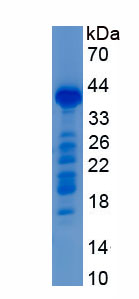 Recombinant Procollagen III N-Terminal Propeptide (PIIINP)