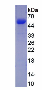 Recombinant Procollagen III N-Terminal Propeptide (PIIINP)