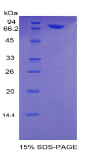 RPA576Hu05.jpg