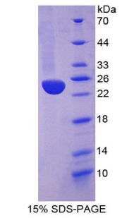 Recombinant Heme Oxygenase 1 (HO1)