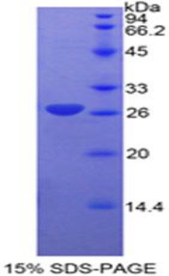 Recombinant Cyclin D1 (CCND1)