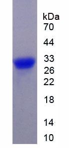 Recombinant Cyclin D1 (CCND1)