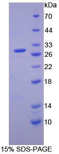 Recombinant Cyclin D2 (CCND2)