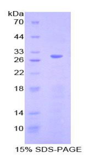 Recombinant Cyclin D2 (CCND2)