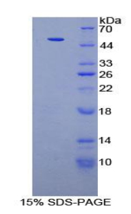 Recombinant Pyruvate kinase isozymes M2 (PKM2)