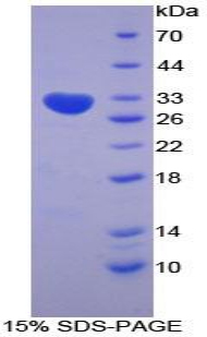 Recombinant Superoxide Dismutase Copper Chaperone