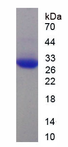 Recombinant Apolipoprotein <b>B100</b> (APO<b>B100</b>)