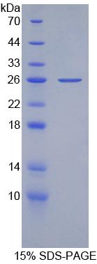 Recombinant Apolipoprotein <b>B100</b> (APO<b>B100</b>)