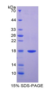 Recombinant Adiponectin (ADPN)