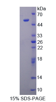 Recombinant Adiponectin (ADPN)