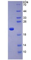 Recombinant Adiponectin (ADPN)