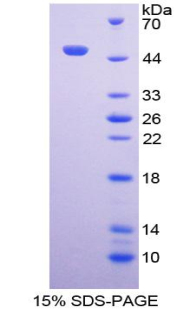 Recombinant Neuroglobin (NGB)