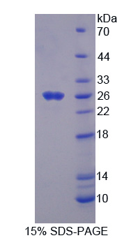 Recombinant Thrombospondin 1 (THBS1)