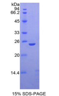 Recombinant Thrombospondin 1 (THBS1)