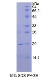 Recombinant Thrombospondin 1 (THBS1)