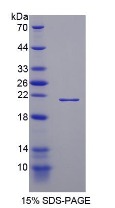 Recombinant Thrombospondin 1 (THBS1)