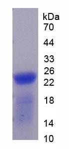 Recombinant Thrombospondin 1 (THBS1)