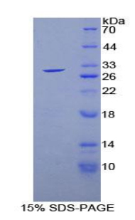 Recombinant Glutathione S Transferase Theta 2 (GSTt2)