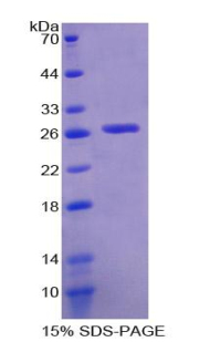 Recombinant Glutathione S Transferase Theta 2 (GSTt2)