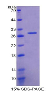 Recombinant Glutathione S Transferase Theta 2 (GSTt2)