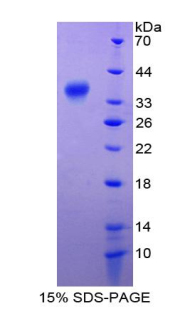 Recombinant Transcription Factor P65 (NFKB3)