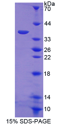 Recombinant Transcription Factor P65 (NFKB3)