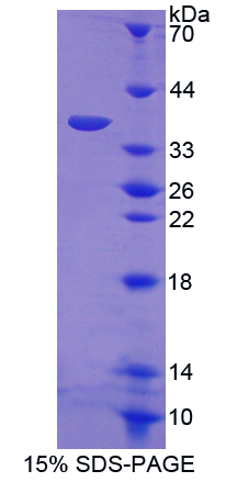 Recombinant Transcription Factor P65 (NFKB3)