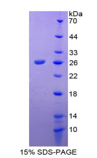 Recombinant Tachykinin Receptor 2 (TACR2)