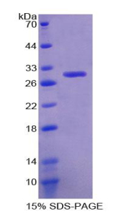 Recombinant Glutathione S Transferase Theta 1 (GSTt1)