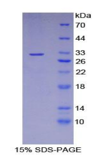 Recombinant Glutathione S Transferase Omega 1 (GSTo1)