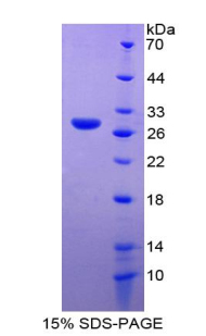 Recombinant Glutathione S Transferase Omega 1 (GSTo1)