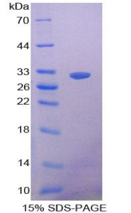 Recombinant Nitric Oxide Synthase Trafficker (NOSTRIN)