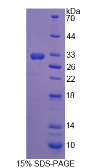 Recombinant Nitric Oxide Synthase Trafficker (NOSTRIN)