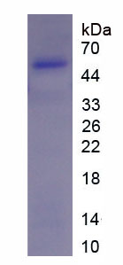 Recombinant Glycogen Synthase Kinase 3 Alpha (GSK3a)